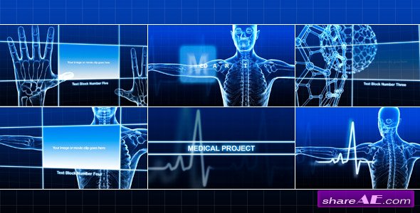 Medical Project - After Effects Project (Videohive)